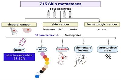 Dermoscopy of skin metastases in advanced cancer—systemic (visceral, hematologic) and cutaneous